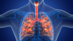 Livshotande lungfibros kan lindras med hälsosamma omega-3-fettsyror