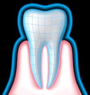 Periodontitis increases the risk of myocardial infarction