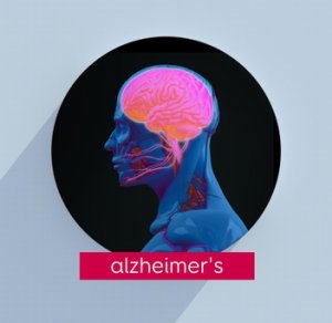 Alzheimers nye navn er type 3-diabetes