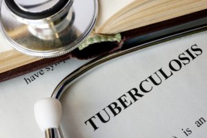 Vitamin D supplements support therapy for multi-resistant tuberculosis