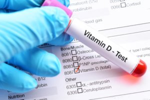 Vitamin D can successfully be measured in hair and deliver a more accurate time image