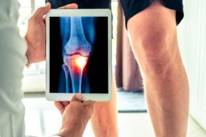 Magnesium in our diet is important for healthy knees and for preventing osteoarthritis
