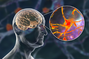 Alzheimers: Mere omega-3 kan halvere risikoen