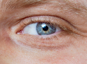 Selenium helps prevent age-related cataracts
