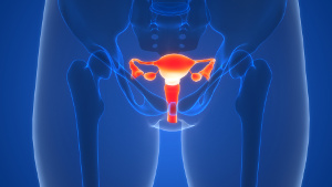 Chromtilskud har terapeutisk effekt ved PCOS Chromtilskud har terapeutisk effekt ved PCOS
